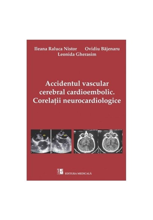 Accidentul vascular cerebral cardioembolic. Corelații neurocardiologice