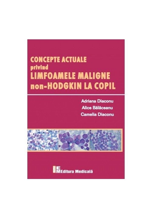 Concepte actuale privind limfoamele maligne non-Hodgkin la copil